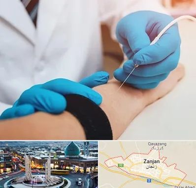 مرکز نوار عصب و عضله در زنجان