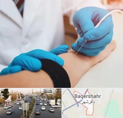 مرکز نوار عصب و عضله در باقرشهر