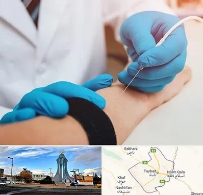 مرکز نوار عصب و عضله در تایباد