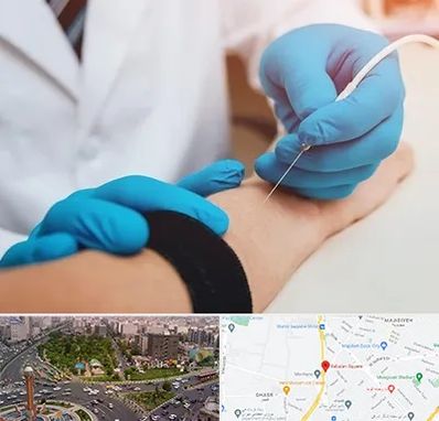 مرکز نوار عصب و عضله در سبلان 