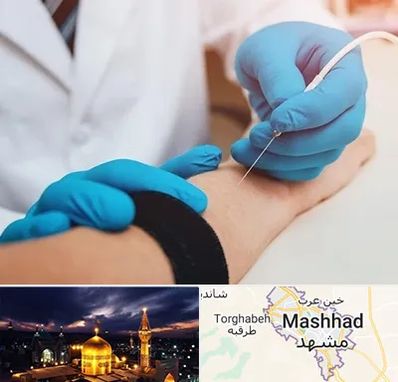 مرکز نوار عصب و عضله در مشهد