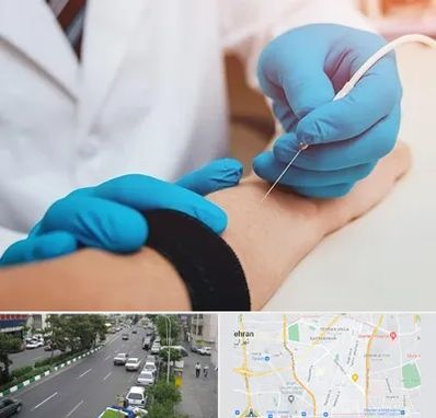 مرکز نوار عصب و عضله در ستارخان 