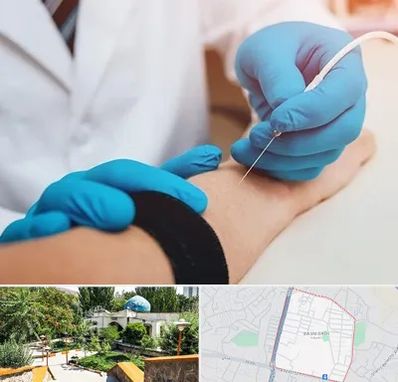 مرکز نوار عصب و عضله در باغمیشه تبریز