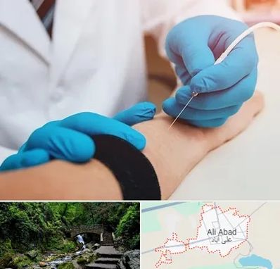 مرکز نوار عصب و عضله در علی آباد کتول