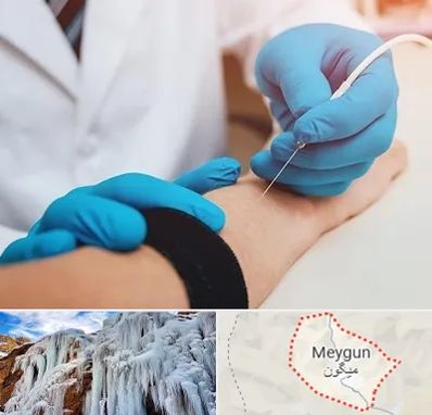 مرکز نوار عصب و عضله در میگون