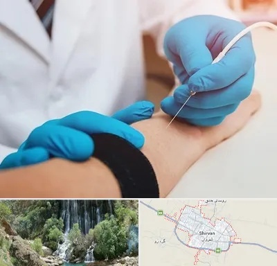 مرکز نوار عصب و عضله در شیروان