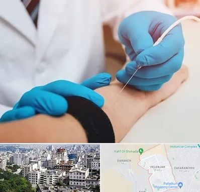 مرکز نوار عصب و عضله در ولنجک 