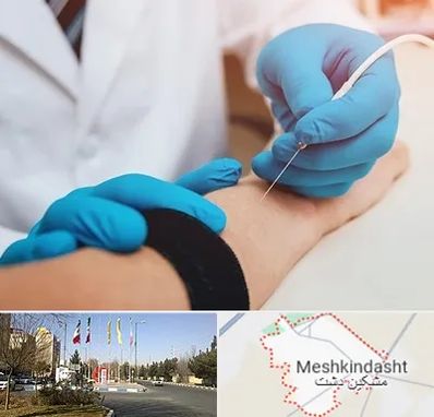 مرکز نوار عصب و عضله در مشکین دشت