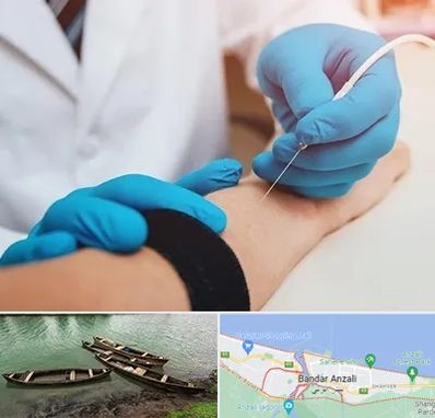 مرکز نوار عصب و عضله در بندر انزلی