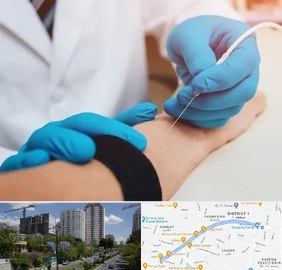 مرکز نوار عصب و عضله در اندرزگو 