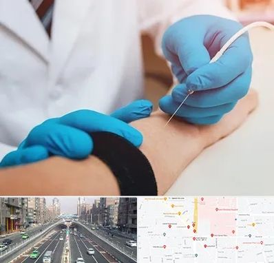 مرکز نوار عصب و عضله در توحید 