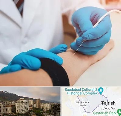 مرکز نوار عصب و عضله در زعفرانیه 