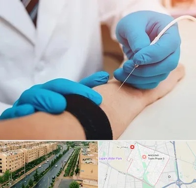 مرکز نوار عصب و عضله در فاز سه اندیشه