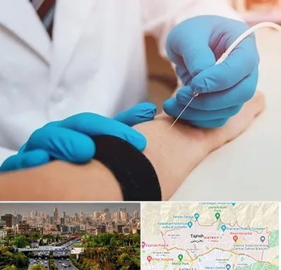 مرکز نوار عصب و عضله در منطقه 1 تهران 