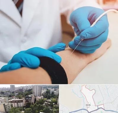 مرکز نوار عصب و عضله در اوین