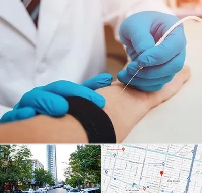 مرکز نوار عصب و عضله در امامت مشهد 