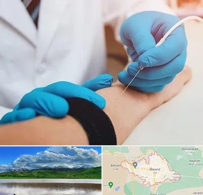 مرکز نوار عصب و عضله در مرند