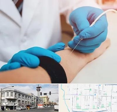 مرکز نوار عصب و عضله در 17شهریور