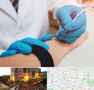 مرکز نوار عصب و عضله در جنت آباد تهران 