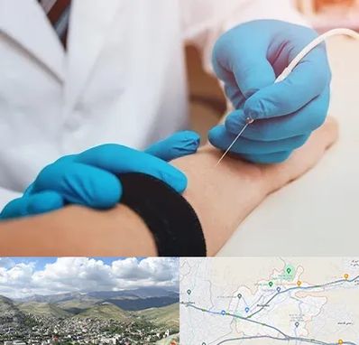 مرکز نوار عصب و عضله در رودهن