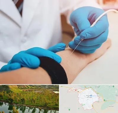 مرکز نوار عصب و عضله در بهبهان