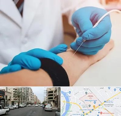 مرکز نوار عصب و عضله در زیتون کارمندی اهواز 