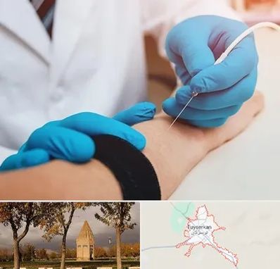 مرکز نوار عصب و عضله در تویسرکان