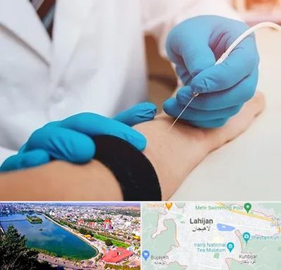 مرکز نوار عصب و عضله در لاهیجان