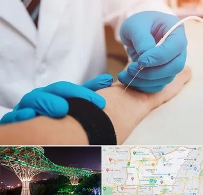 مرکز نوار عصب و عضله در منطقه 3 تهران 