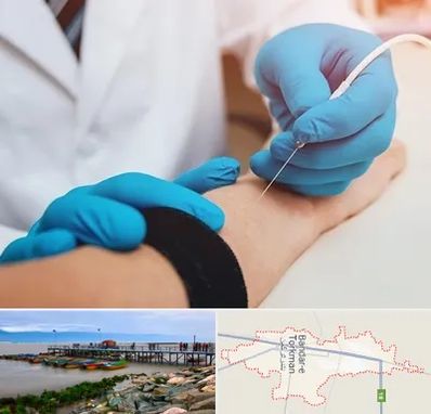 مرکز نوار عصب و عضله در بندر ترکمن