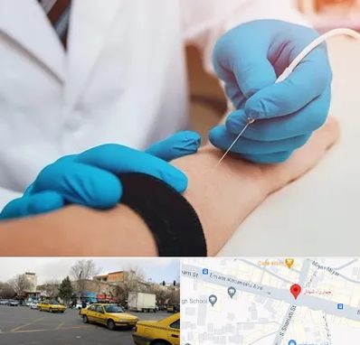 مرکز نوار عصب و عضله در شهناز تبریز