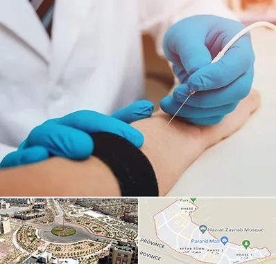 مرکز نوار عصب و عضله در پرند