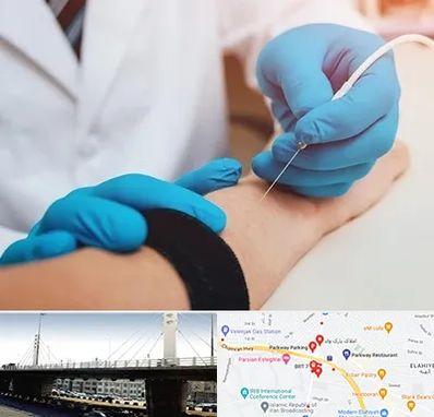 مرکز نوار عصب و عضله در پارک وی 