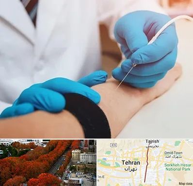 مرکز نوار عصب و عضله در ولیعصر 