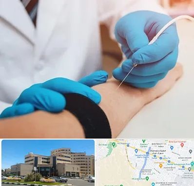 مرکز نوار عصب و عضله در صیاد شیرازی مشهد 