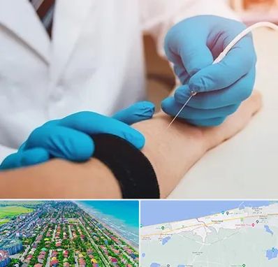 مرکز نوار عصب و عضله در فریدونکنار