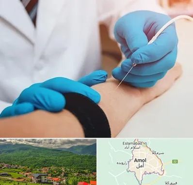 مرکز نوار عصب و عضله در آمل