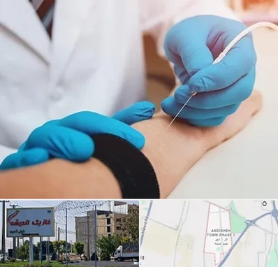 مرکز نوار عصب و عضله در فاز یک اندیشه