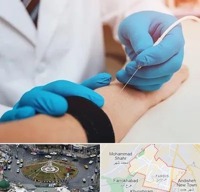 مرکز نوار عصب و عضله در فردیس کرج 