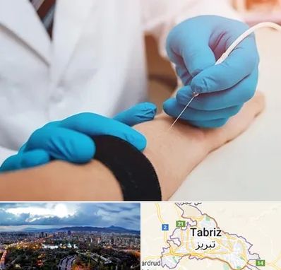 مرکز نوار عصب و عضله در تبریز