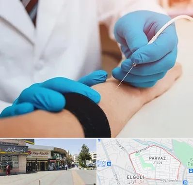 مرکز نوار عصب و عضله در پرواز تبریز