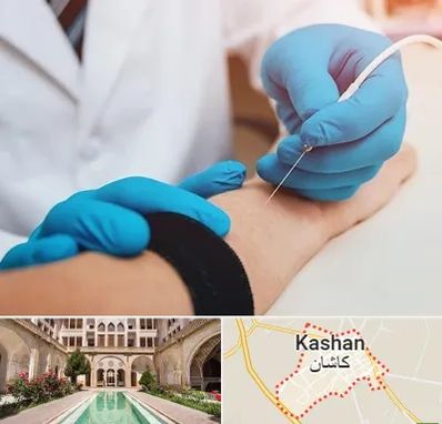 مرکز نوار عصب و عضله در کاشان