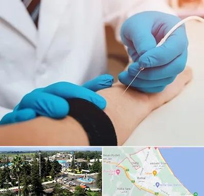 مرکز نوار عصب و عضله در رودسر