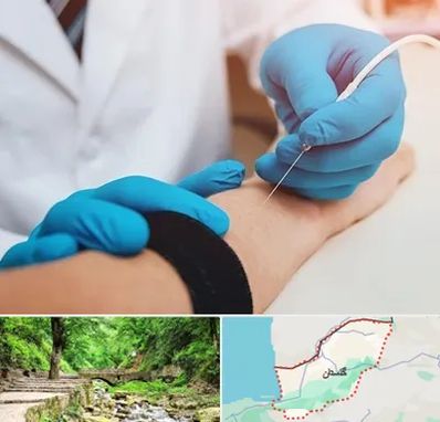 مرکز نوار عصب و عضله در گلستان