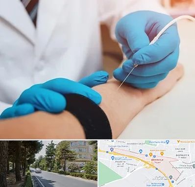 مرکز نوار عصب و عضله در مهرویلا کرج 