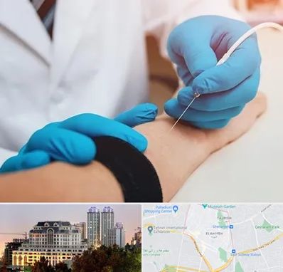 مرکز نوار عصب و عضله در فرشته 