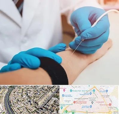 مرکز نوار عصب و عضله در شهرک غرب مشهد 