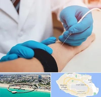مرکز نوار عصب و عضله در کیش