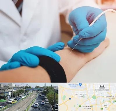 مرکز نوار عصب و عضله در جنوب تهران 