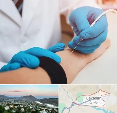 مرکز نوار عصب و عضله در لواسان